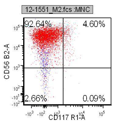 Figure 7e. Flow cytometry, Ethmoid sinus, CD56 bright